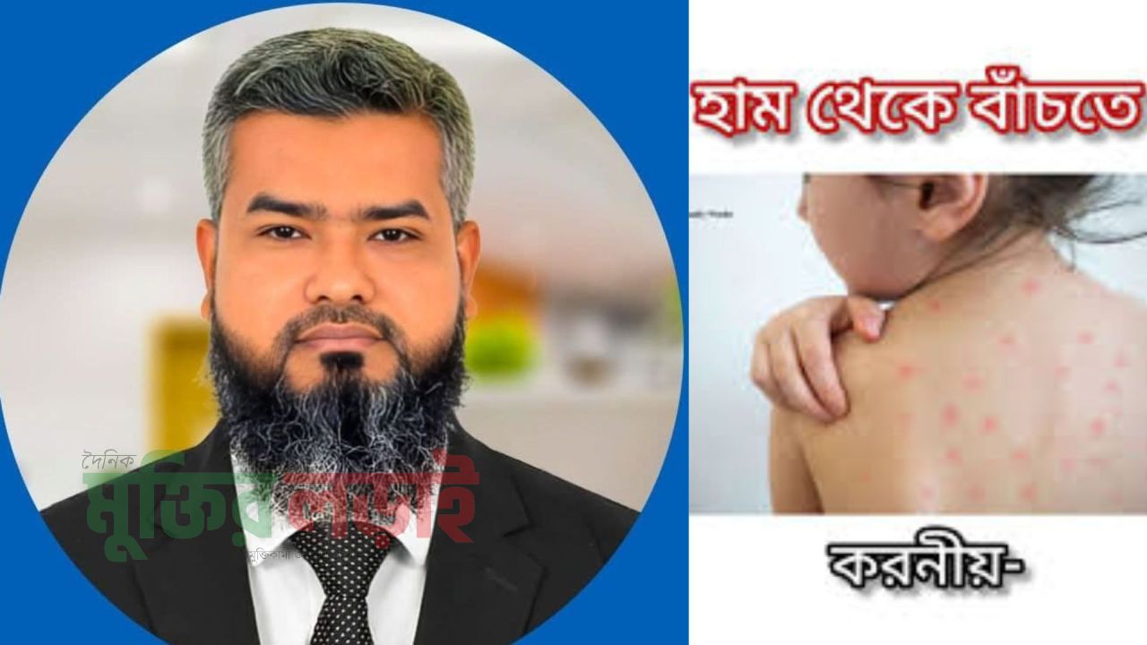 অবহেলা নয়—হাম প্রতিরোধে প্রয়োজন সচেতনতা