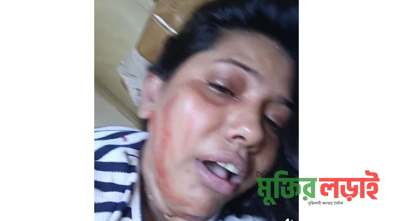 রামপুরায় স্বামীর নির্যাতনের শিকার কণ্ঠশিল্পী শায়রিন