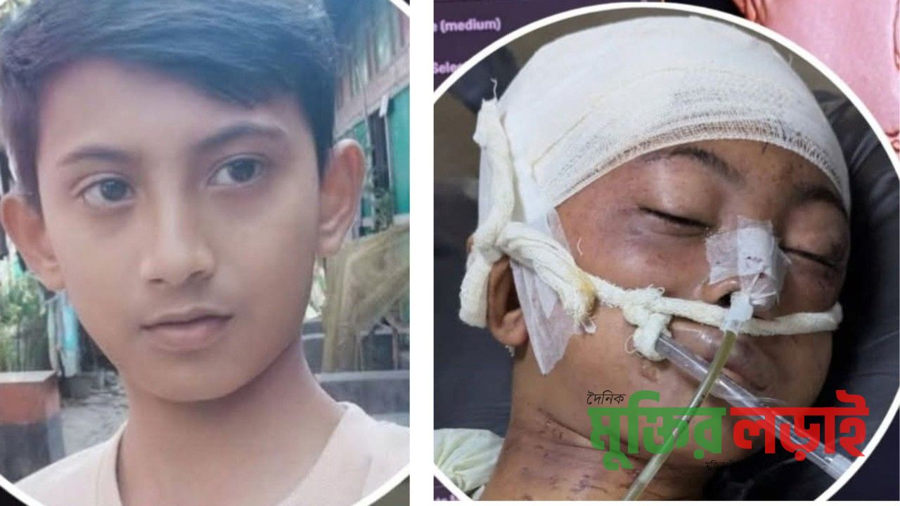 বরুড়ায় কিশোর লাবিবকে নৃশংস ভাবে হত্যার চেষ্টা, আটক দুই