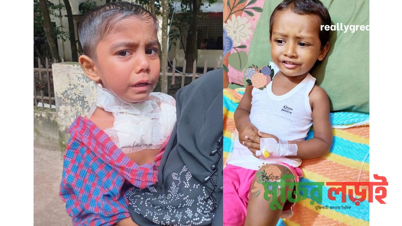 বরুড়ায় পাগলা কুকুরের কামড়ে অন্তত ১৬ জন আহত